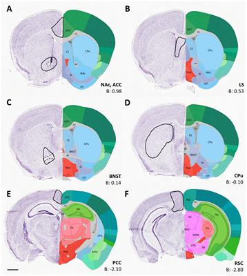 Early cellular and synaptic changes in dopaminoceptive forebrain regions of juvenile mice following gestational exposure to valproate